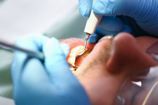 Best Emergency Dental Services for Seniors in Toledo, OH